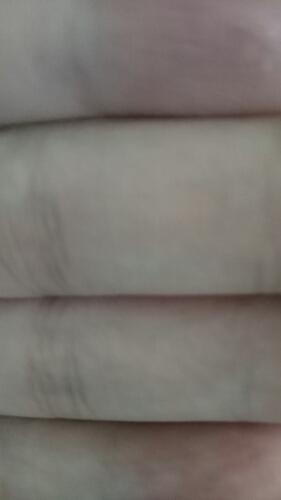 Testbugimage